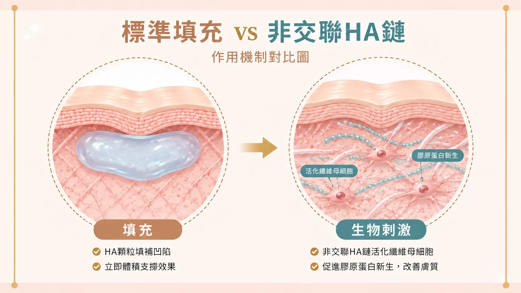 彈力針生物刺激與填充型玻尿酸作用機制差異示意圖