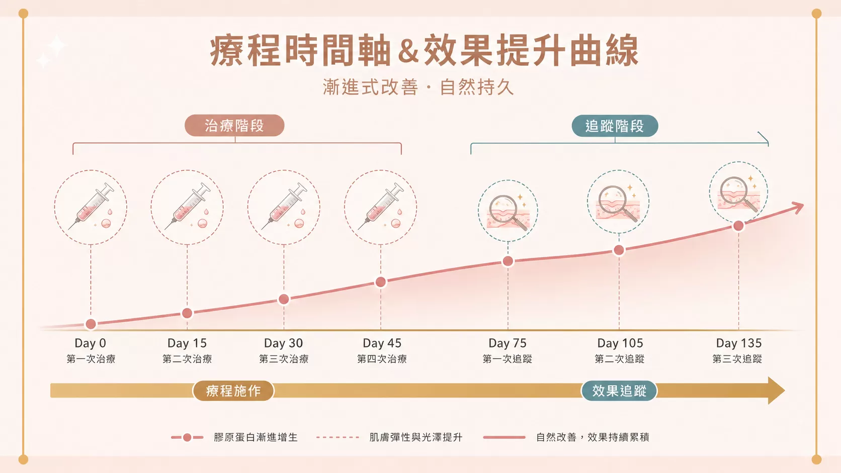 彈力針標準療程時間軸，4次療程追蹤至第135天效果維持示意圖