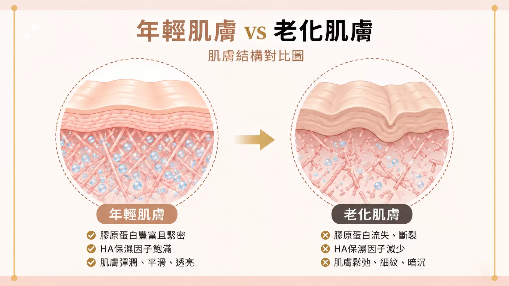 彈力針療程原理｜年輕皮膚與老化皮膚ECM結構對比示意圖