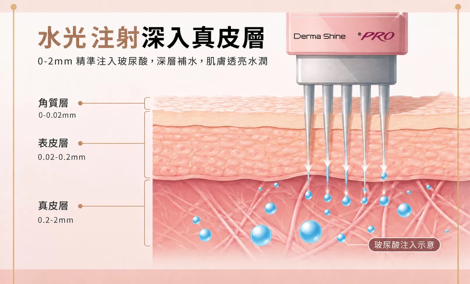 德瑪莎水光注射將玻尿酸精準導入真皮層原理示意圖