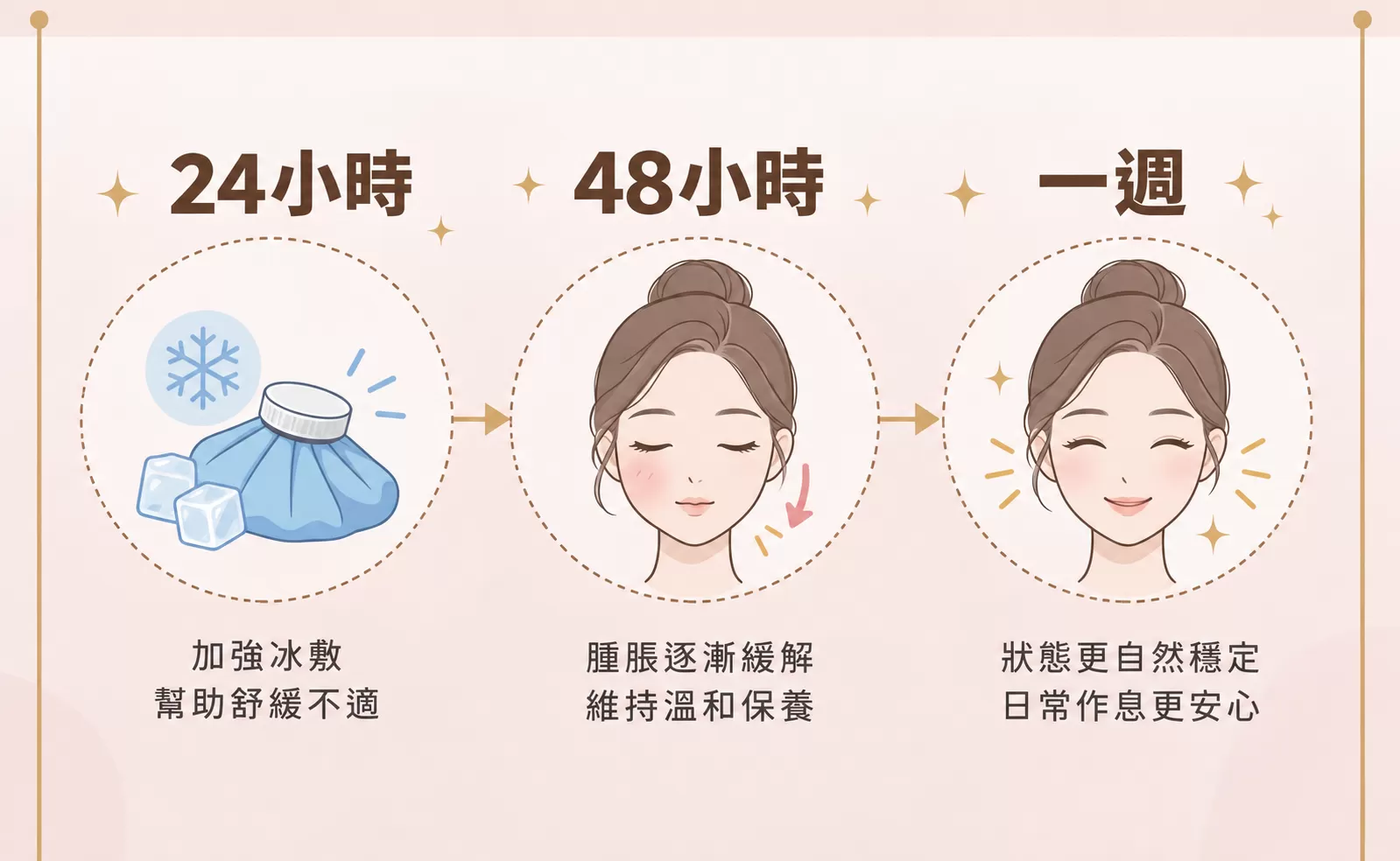 媄神針術後照護時間軸,24小時、48小時、一週恢復重點示意