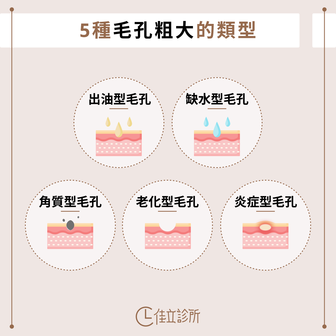 毛孔粗大的類型 