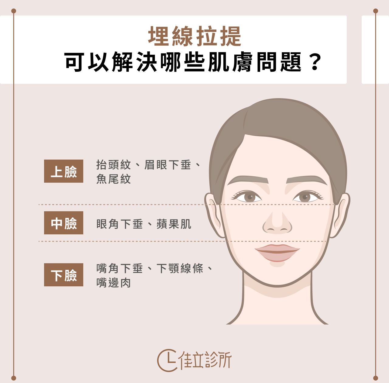 埋線拉提適用部位