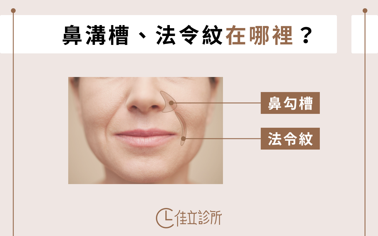 法令紋鼻溝槽