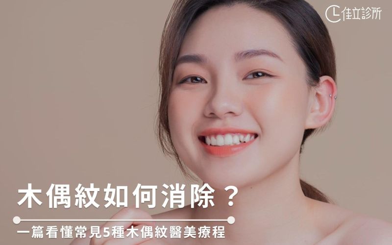 木偶紋如何消除？一篇看懂常見5種木偶紋醫美療程