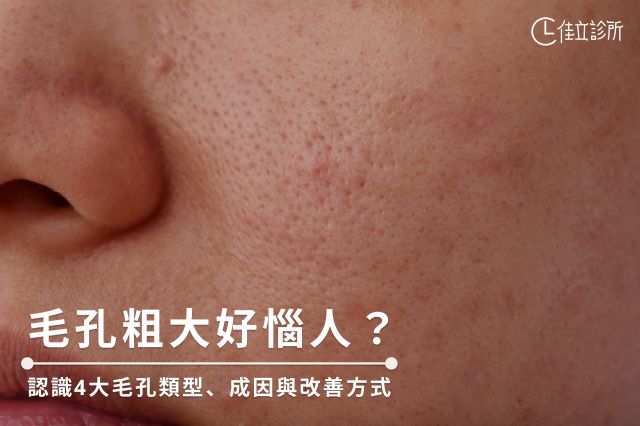 如何縮小毛孔？有效改善毛孔粗大的秘訣